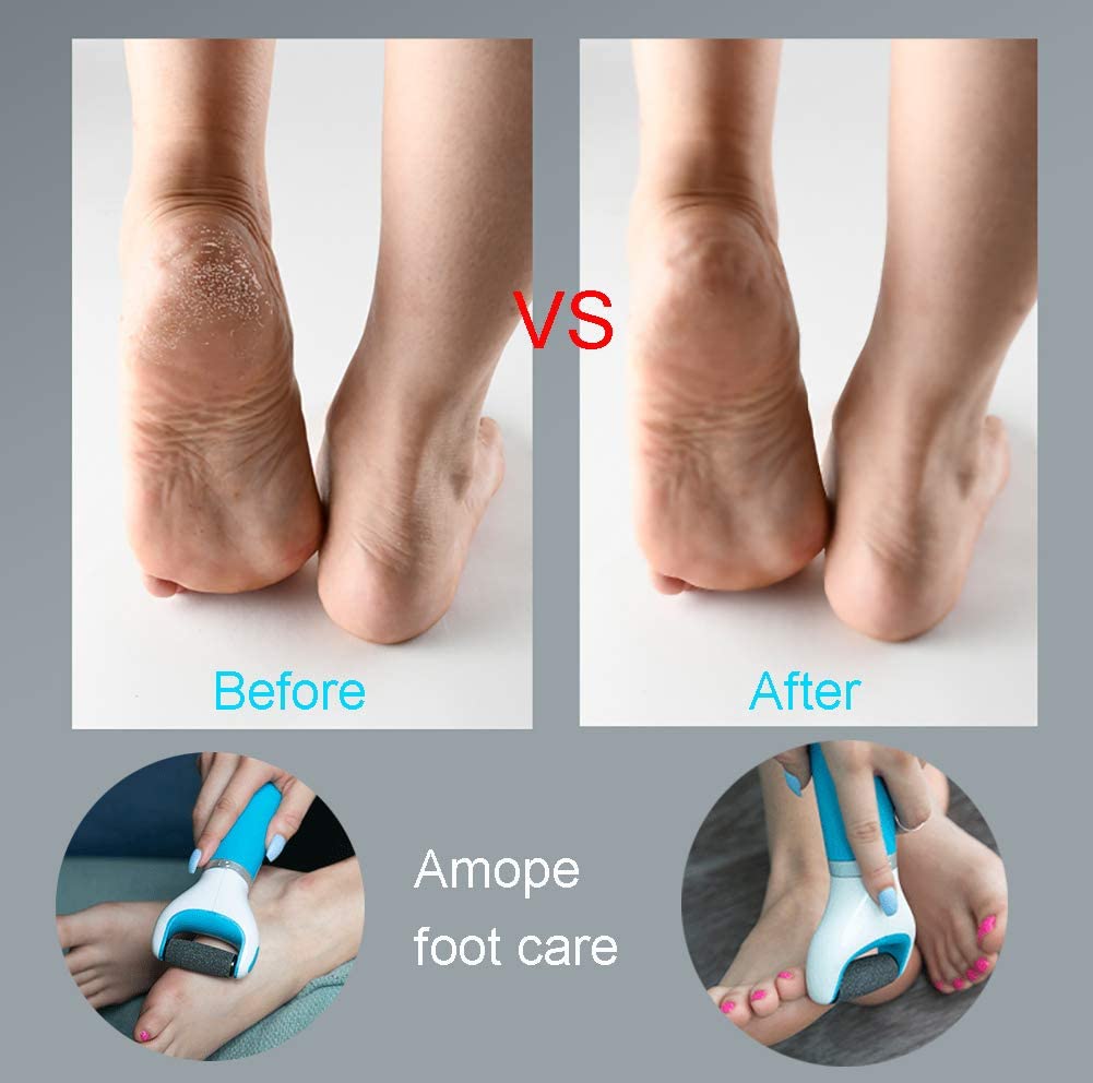 Velvet Smooth Electronic Foot File